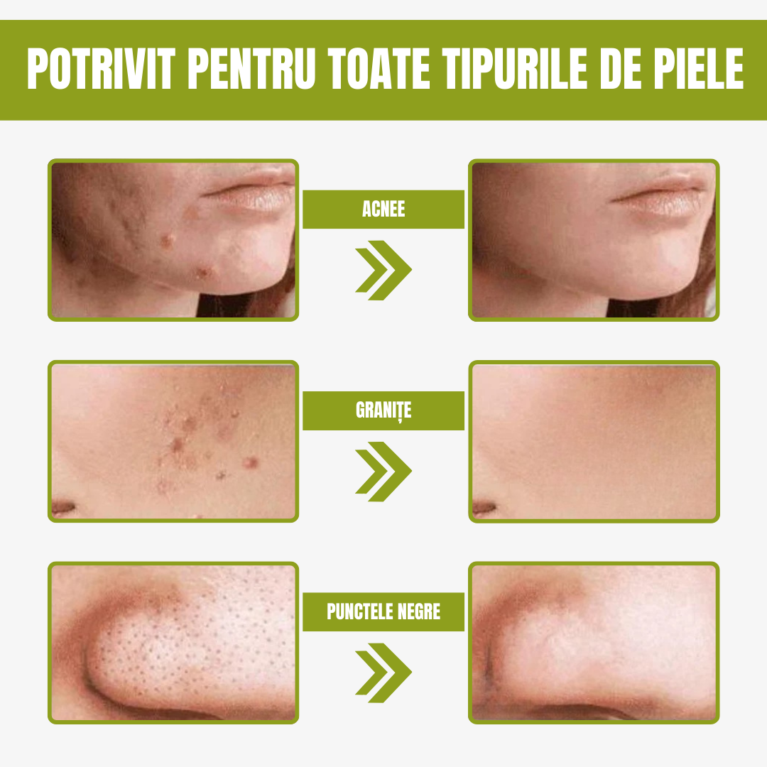 Mască verde pentru ten Ofertă 3 x 1