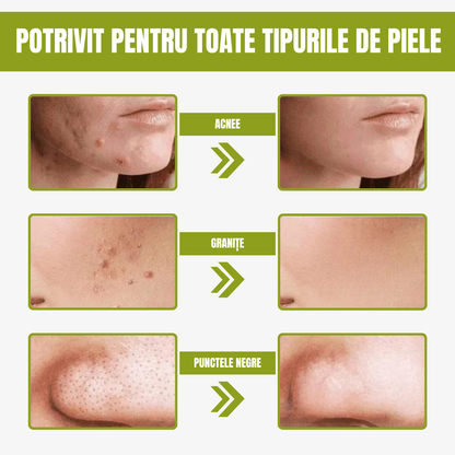 Mască verde pentru ten Ofertă 3 x 1